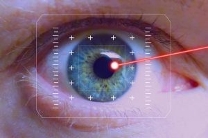 lente-contato-laser